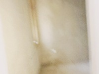 5室3廳3陽臺 湖畔之夢別墅戶型圖